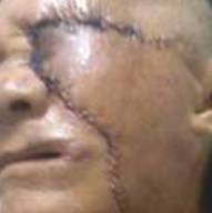 Per&iacute;odo posoperatorio 