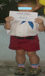 Nótese la postura y speudohipertrofia de los gemelos en el paciente a los 7 años de edad