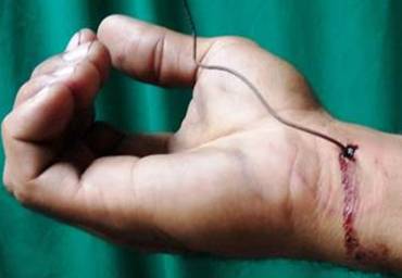 Sitio de entrada del objeto