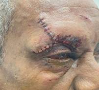 Paciente en el per&iacute;odo posoperatorio inmediato