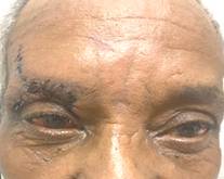 Evoluci&oacute;n a los 14 d&iacute;as