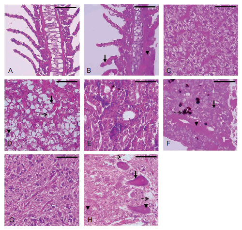 Lesiones histopatológicas asociadas con exposición subcrónica a dosis subletal de clorpirifós (CPF) sin recuperación (hematoxilina y eosina, 40 X). Testigos y clorpirifós (CPF, 0.011 µg/L). Branquias. (a) Testigo, espacios interlamelares limpios y células de morfología uniforme. (b) CPF, muestra, la hipertrofia del epitelio laminar (flecha) e hiperplasia interlamelar moderada (cabeza de flecha). Hígado. (c) Testigo, apariencia normal de hepatocitos. (d) CPF, amplia lipidosis, estructuras intracelulares-vacuolas (flecha), pleomorfismo nuclear (cabeza de flecha), fragmentación nuclear (flecha punteada). Riñón caudal. (e) Testigo, apariencia normal de estructuras tubulares. (f) CPF, nefrosis vacuolar del epitelio tubular, pérdida de estructura y distribución de parénquima (flecha), reducción de espacio de Bowman (cabeza de flecha), melanomacrófagos (flecha punteada). Encéfalo. (g) Testigo, apariencia normal de neuronas con membrana y nucleo bien definidos. (h) CPF, degeneración neuronal con hipertrofia celular (flecha) y alteración nuclear (núcleo fantasma) (cabeza de flecha) degeneración celular y pérdida del neurópilo (flecha punteada). Barra de escala: 50 µm.