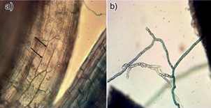 Im&aacute;genes de las estructuras de hongos micorr&iacute;zicos en asociaci&oacute;n con
								Fraxinus uhdei, en (a) c&eacute;lulas corticales cubiertas
							por la red de Hartig y (b) micelio externo de la ra&iacute;z de
								Fraxinus uhdei