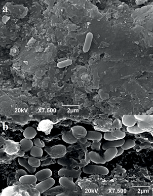 Microscopia electr&oacute;nica de barrido de c&eacute;lulas de la cepa CrLIM26
								incubadas en ausencia (a) y en presencia de Cr(VI) (b). Aumento
								7500X