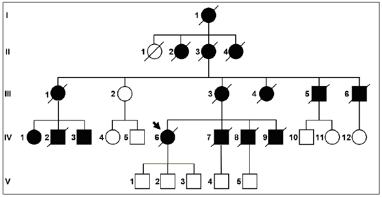 Figura 2. Heredograma de uma famlia argentina com a mutao N141L no gene PSEN2, mostrando o padro de herana autossmico dominante da DAIP. O indivduo IV-6  o probando. Os indivduos afetados esto preenchidos de preto