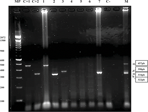 Visualizaci&oacute;n de la tipificaci&oacute;n de VPH mediante electroforesis en gel de agarosa al 2%; MP: Marcador de peso molecular (100 pb Invitrogen); C+1: Control positivo de VPH tipo 16 (indicador a 457pb); C+2: Control positivo de VPH tipo 6 y/u 11 (indicador a 334pb); 1: Muestra de paciente VPH positiva tipo 16; 2: Muestra de paciente VPH positiva tipo 18; 3: Muestra de paciente VPH positiva tipo 33; 4, 5, 6: Muestras de pacientes VPH positivas No Tipificables por esta metodolog&iacute;a; 7: Muestra de paciente VPH positiva tipo 6 y/o 11 (334pb); C-: Control negativo; M: Control positivo con la mezcla de genotipos de VPH tipos 18 (322 pb), 6 y/u 11 (334 pb), 33 (398 pb) y 16 (457 pb).