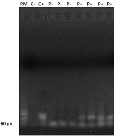Gel de agarosa al 3%, muestra corrida del gen p73, PM: marcador de peso molecular 50pb, c+: control positivo, c-: control negativo, p+: paciente positivo, p-: paciente negativo.