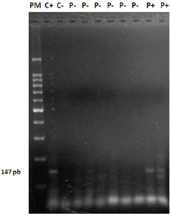 Gelde agarosa al 2%, muestra corrida del gen p15, PM: marcador de peso molecular, C+: control positivo, C-: control negativo, P-: pacientes negativos, P+: pacientes positivos.