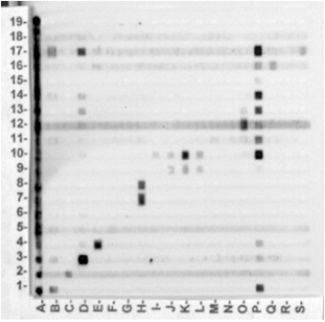 Representative &ldquo;CrossMABA&rdquo; of this stu dy. Numbers from 1 to 19 correspond each to specific antigens for different diseases. Letters from A to S correspond to patients sera.