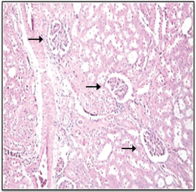 Microfotograf&iacute;a de corteza renal de animales control donde se observan tres glom&eacute;rulos renales viables (flechas), sin aparentes cambios segmentarios o difusos, con una matriz y celularidad mesangial conservada, paredes capilares con espesor regular y luces abiertas con espacio urinario amplio. (250X, hematoxilina-eosina).