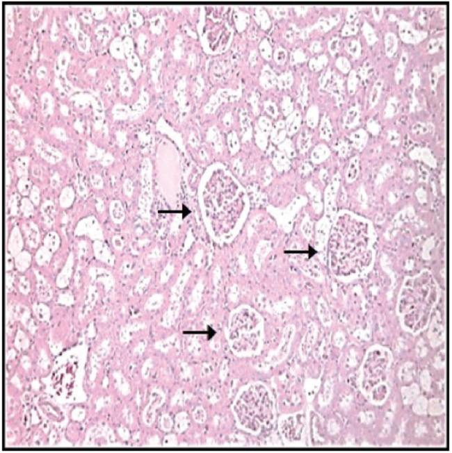Microfotograf&iacute;a de corteza renal de animales diab&eacute;ticos tratados con sulodexide donde se observan glom&eacute;rulos renales (flechas) en su mayor&iacute;a con una estructura renal cercana a lo normal y sin adherencias a la capsula de Bowman. (250X, hematoxilina-eosina).