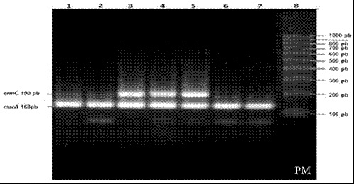 Resultados de PCR del gen msrA (163 pb) y el gen ermC (190 pb). Los carriles muestran dos bandas que corresponden a la amplificaci&oacute;n del gen msrA y el gen ermC (PM: marcador de peso molecular).
