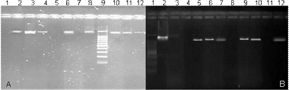 Productos de PCR para los genes icaA (1200 pb) e icaB (900pb) en S. aureus. A) icaA: carriles 1,5: cepas negativas; carriles 2-4,6,10-12 cepas positivas; carril 7: control de reactivos; carril 8: cepa ATCC control +; carril 9: marcador de PM. B) icaB Carril 1: marcador de PM; carril 3 cepa ATCC control +; carril 3: control de reactivos; carriles 5-7,9,10,12 cepas positivas; carriles 4,8,11: cepas negativas