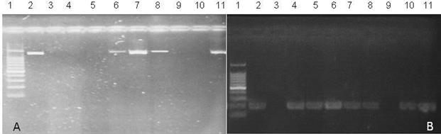 Productos de PCR para los genes icaC (1100pb) e icaD en S. aureus. A) icaC: carril 1: marcador de PM; carril 2: cepa ATCC control, positivo; carril 3: control de reactivos; carriles 6-8,11: cepas positivas; carriles 4,5,9,10: cepas negativas. B) icaD (198pb) en S. aureus. Carril 1: marcador de PM: carril 2: cepas ATCC control +; carril 3; control de reactivos; carriles 4-8,10,11: cepas positivas; carril 9: cepa negativa.