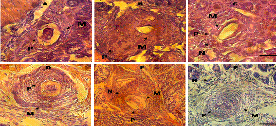 Secciones de granulomas de intestinos de RI8S (A, B y C) y de RI20S (D, E y F) te&ntilde;idas con H&E. A) Granulomas peque&ntilde;os, de bordes no definidos, con predominio de macr&oacute;fagos y presencia de plasmocitos (P), no se observaron neutr&oacute;filos. B) Granulomas grandes, con borde definido, constituido por macr&oacute;fagos (M) y plasmocitos. C) Granulomas sin borde definido, con un &aacute;rea interna constituida por macr&oacute;fagos (M) y plasmocitos (P), y escasos neutr&oacute;filos (N) en el &aacute;rea externa. D) Granulomas constituidos por abundantes macr&oacute;fagos (M) y escasos plasmocitos (P), &aacute;rea externa conformada por macr&oacute;fagos (M). E) Granulomas de tama&ntilde;os mediano, sin &aacute;reas definidas dentro del granuloma, conformado por macr&oacute;fagos (M), plasmocitos (P) y neutr&oacute;filos (N). F) Granulomas de tama&ntilde;o mediano, el &aacute;rea interna conformada por plasmocitos (P) y escasos macr&oacute;fagos (M), en el &aacute;rea media se observa por una hilera de macr&oacute;fagos que la separa del &aacute;rea externa constituida principalmente de macr&oacute;fagos y algunos neutr&oacute;filos. Barra= 25&micro;m.