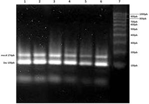 Los carriles 1 al 6 muestran 2 bandas: una superior que concierne a la amplificaci&oacute;n del gen mecA (174 pb) y una inferior que representa al control interno para la identificaci&oacute;n de S. aureus (108 pb).