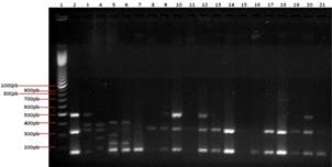 Carril 1 MPM (100bp); carriles del 2 al 8 controles positivos (carril 2 SSCmec tipo I; carril 3 SSCmec tipo IA; carril 4 SSCmec tipo II; carril 5 SSCmec tipo III; carril 6 SSCmec tipo IIIA; carril 7 SSCmec tipo IIIB y carril 8 SSCmec tipo IV). Carriles del 9 a 21 muestras