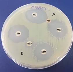 Prueba de Sinergia con inhibidores de carbapenemasas. (A) Prueba de sinergia positiva entre ácido fenilborónico (APB) y los dos carbapenémicos probados, meropenem (MEM) e imipenem (IPM). (B) Prueba de sinergia negativa entre EDTA y los dos carbapenémicos probados: meropenem (MEM) e imipenem (IPM). Se presume presencia de carbapenemasa KPC por sinergia positiva entre ácido fenilborónico con imipenem y meropenem.
