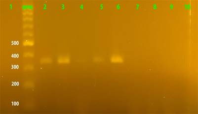 Electroforesis en geles de agarosa de los productos de amplificación de una región del gen cytK incluida la caja plcR. Carril 1, B424. 2, B425. 3, B426. 4, B427. 5, B430. 6, B455. 7, B428. 8, B432. 9, B. subtilis. 10, se utilizó agua estéril como control negativo. MPM. Marcador de peso molecular de 100 pb.