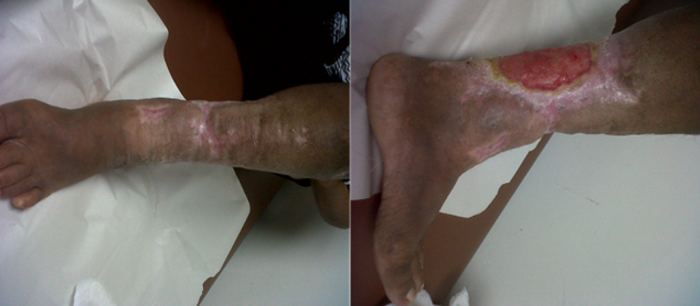 Clinical progression 9 months after discharge.