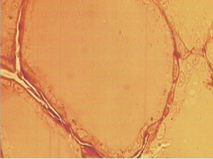 -Estudio histol&oacute;gico (tinci&oacute;n p-fenil-endiamina) de gl&aacute;ndula tiroides del grupo expuesto a mayor aumento (40X) se evidencia aplanamiento del epitelio folicular tiroideo, y el lumen de dicha c&eacute;lula folicular contiene gran cantidad de sustancia coloide.