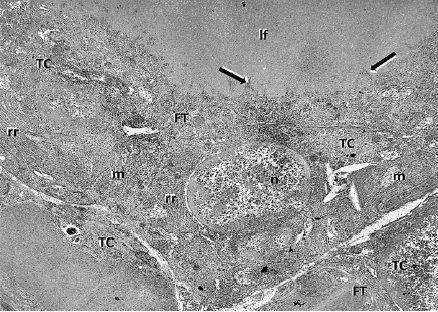 - Segmentos de fol&iacute;culos tiroideos de muestra control conformados por tirocitos (TC) que presentan las caracter&iacute;sticas citot&iacute;picas de un epitelio de tipo c&uacute;bico, con abundantes mitocondrias (m) y ret&iacute;culo endopl&aacute;smico rugoso (rr). La superficie luminal de estas c&eacute;lulas muestra cortas microvellosidades (flechas). n, n&uacute;cleo; FT, fol&iacute;culo tiroideo; lf, luz del fol&iacute;culo. X3000. 