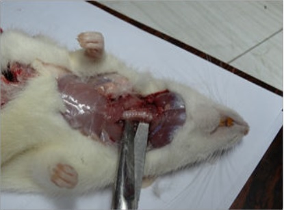 -Ubicaci&oacute;n de la gl&aacute;ndula tiroides.