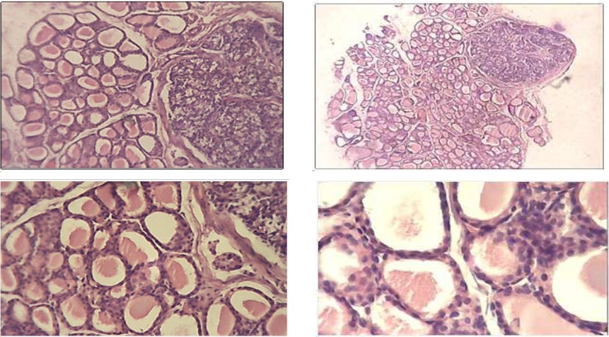 - Estudio histol&oacute;gico (tinci&oacute;n hematoxilina-eosina) de tiroides de grupo control. Se observan c&eacute;lulas foliculares normales. N&oacute;tese el epitelio folicular tiroideo c&uacute;bico simple de morfolog&iacute;a normal