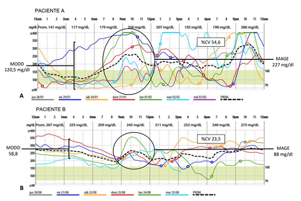Alta variabilidad gluc&eacute;mica (Paciente A) vs baja variabilidad gluc&eacute;mica (Paciente B).