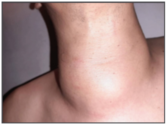 Evaluacin inicial al examen fsico.