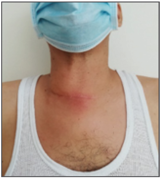 Control postquirrgico.