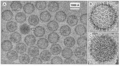 Microfotografía electrónica del
VHH-8. (A): cápside completa (flecha), (B): capsómeros (flecha), (C): patrón de “huella digital”.