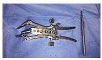 Maxcess Access
Surgical System Retractor&reg;