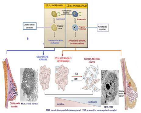 Posible origen y participación de las células
madre del cáncer en el cáncer mamario. MET: microscopía electrónica de
transmisión. CTM: célula de tumor mamario.  

 