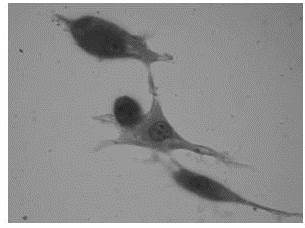  Células madre del cáncer mamario CD44+/CD24-.
Inmunocitoquímica de cultivo celular. HRP. 40X.