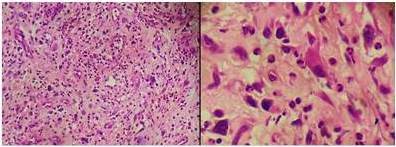 Revisi&oacute;n de l&aacute;minas (D15-054) (B641-15). Coloraci&oacute;n
Hematoxilina-Eosina