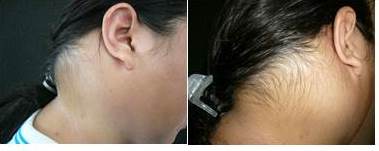 Examen f&iacute;sico: vista lateral
derecha y vista posterior