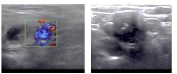 Evaluaci&oacute;n del ecosonograma