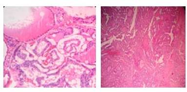 Secciones de la pieza