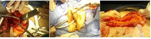 Procedimiento pautado