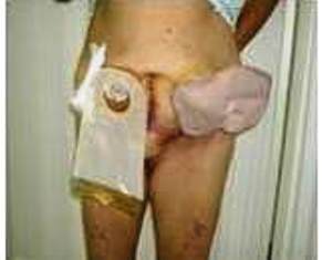 Paciente con evoluci&oacute;n satisfactoria