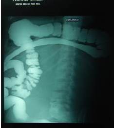 Tr&aacute;nsito intestinal