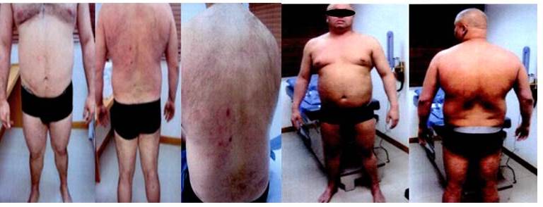 Despu&eacute;s de la RT