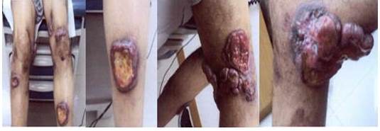 Im&aacute;genes antes de la RTSL