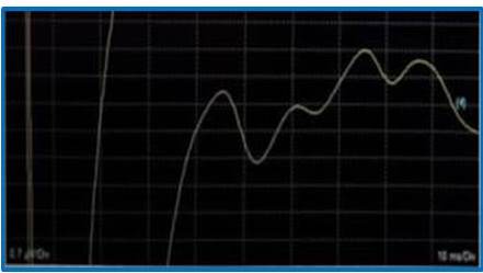 PESS tibial posterior izquierdo.