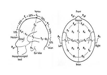 Sistema internacional 10-20 para colocacin de electrodos extracraneal. C: central. F: frontal. P: parietal. T: temporal. Fp: frontopolar o frontal anterior. Pg: nasofaringe. O: occipital. A: oreja o apfisis mastoides. Par: hemisferio derecho. Impar: hemisferio izquierdo.