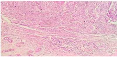 Hematoxilina y Eosina 4X