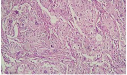 Hematoxilina y Eosina 40X