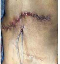 Síntesis por planos