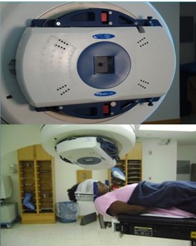 Sistema de conos con arcos no coplanares e inmovilizaci�n con marco estereot�ct